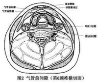 氣管前間隙