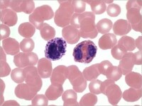 圖片為嗜酸性粒細胞，為血液內組分。