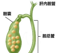 膽汁淤積型肝炎