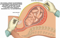 孕期宮高和腹圍標準示意圖