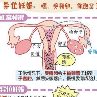 輸卵管