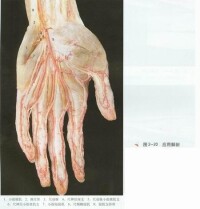 小指展肌肌皮瓣手術示圖