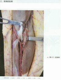 肱橈肌肌皮瓣手術示圖