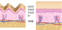 膠原新生重組