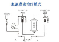 單獨血液灌流