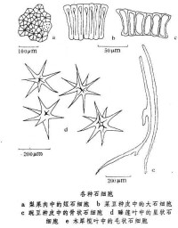 石細胞的細胞圖