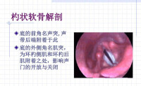 杓狀軟骨