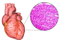心肌細胞