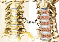 鉤椎關節