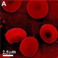 血液中的紅細胞