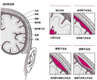 硬膜