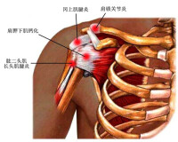 肩椎炎