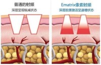 Ematrix像素射頻