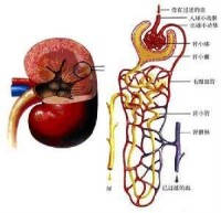 遠端型腎小管酸中毒