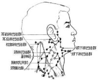 淋巴結切除術