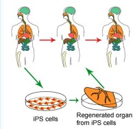 利用再生醫學手段，將受損之肺臟以iPS細胞所形成之臟器組織進行再生。附註：此圖僅為模式圖，與現在技術等具有相當大的差距。