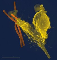 掃描電子顯微鏡圖像一個中性粒細胞（黃色），吞噬了炭疽熱細菌（橙色）。