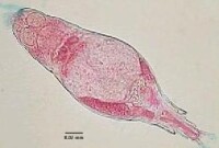 水處理微生物照片