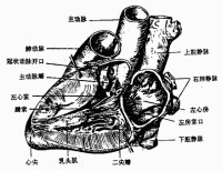 束支折返性室性心動過速