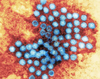 甲型肝炎病毒