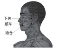 中風發病示意圖