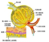 腎病綜合症