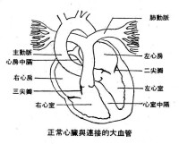 心臟損傷