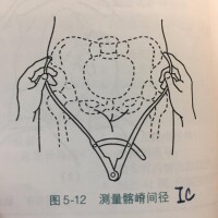 梨型身材