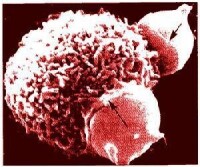 巨噬細胞