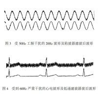 濾波器效果