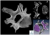 小鼠腰椎骨Micro-CT掃描