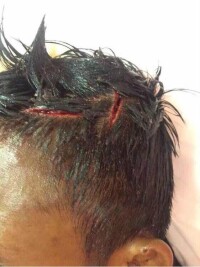 泰拳王被爆頭鮮血噴射 雙方休克進醫院