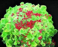 感染HIV的T細胞