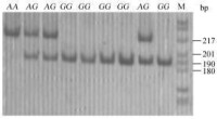 抑制素a亞基基因PCR-RFLP電泳圖譜