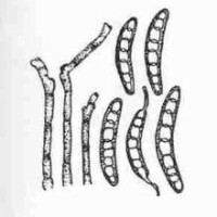 玉米小斑病病原菌分生孢子梗和分生孢子