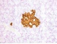 免疫組織化學染色法（DAB顯色）