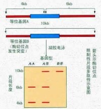 限制性片段長度多態性