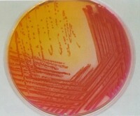 圖1 產氣腸桿菌