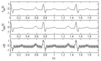 附圖2 純凈的心跳曲線和有污染的心跳曲線