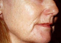 老婦人面部皺紋