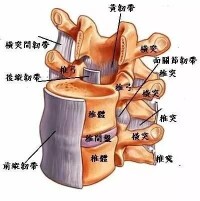 椎管狹窄模式圖