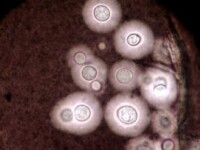 新型隱球菌(Cryptococcus neoformans)