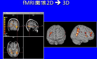 fMRI研究腦功能網路