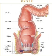 濕熱便血