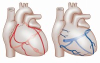 冠狀動脈解剖示意圖（剝除心包、心耳）