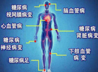 糖尿病慢性併發症