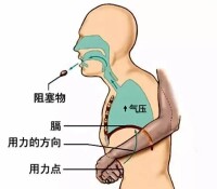 急救技術