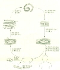 繞蟲病病理圖片