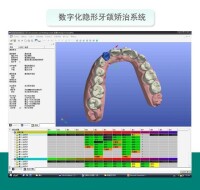 隱形牙齒矯正