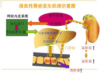 先天性非溶血性黃疸